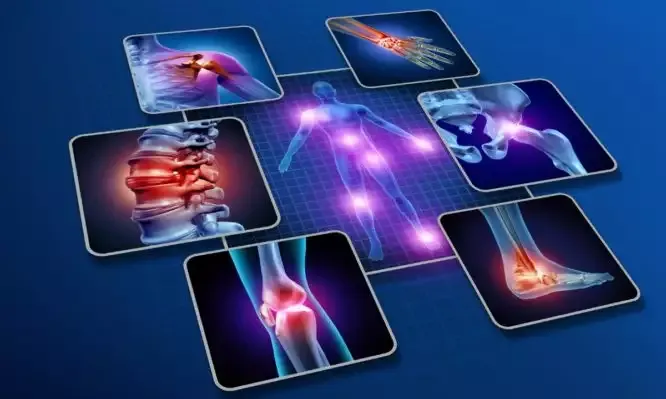 Tại sao phòng ngừa bệnh xương khớp lại quan trọng?