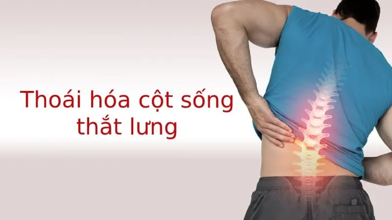 Mục tiêu của việc điều trị thoái hóa cột sống thắt lưng