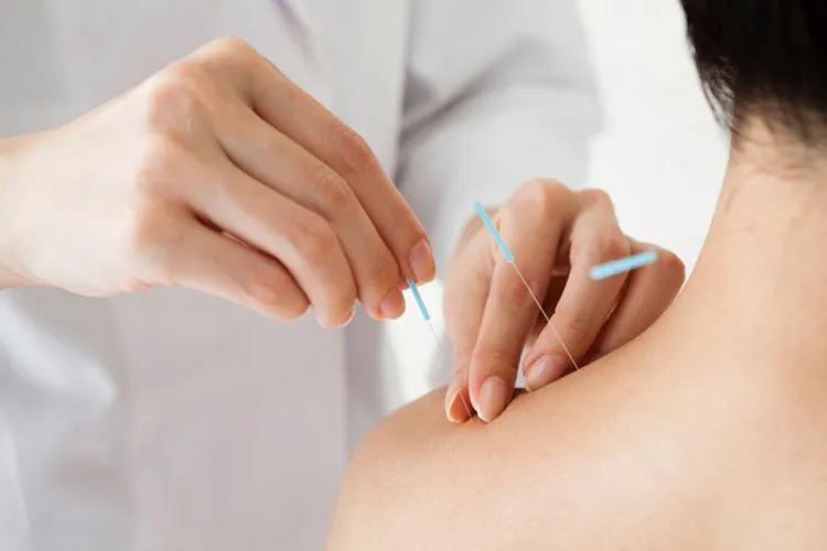 Điều gì sẽ xảy ra trong một buổi châm cứu chữa đau xương khớp?