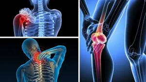 Cách giảm đau khớp hiệu quả