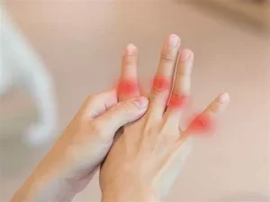 Đau khớp cổ tay và ngón tay là bệnh gì?