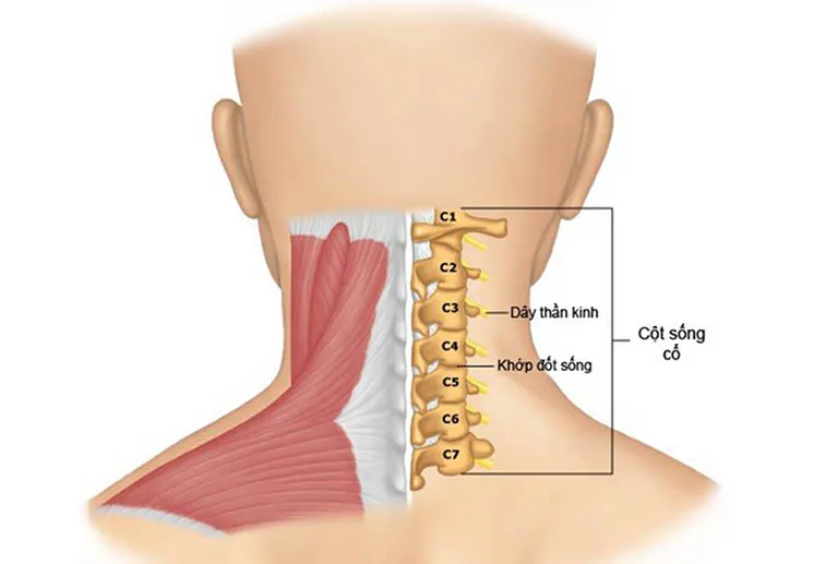 Thoái hóa cột sống cổ: Vấn đề sức khỏe thường gặp