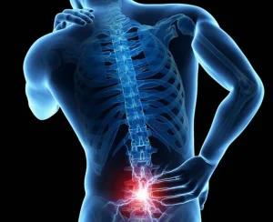 Đau thần kinh tọa là bệnh gì?