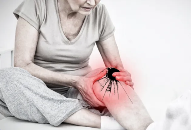Thoái Hóa Khớp Gối: "Kẻ Thù" Của Tuổi Già