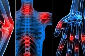 Viêm khớp dạng thấp nên ăn gì?