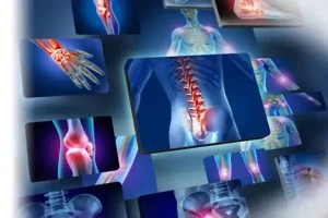 Cách phòng ngừa bệnh xương khớp