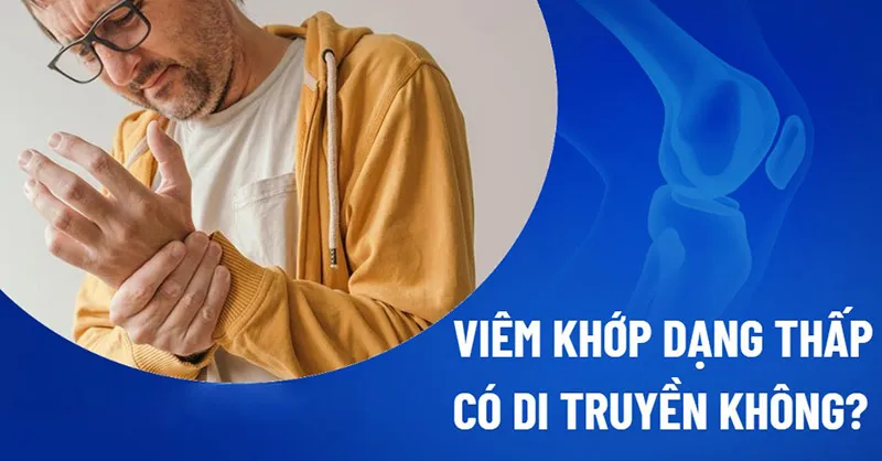 Viêm khớp dạng thấp có di truyền không?